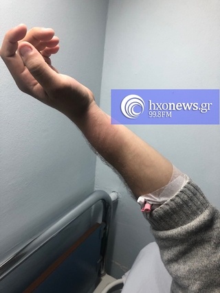 hxonews