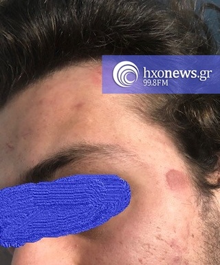hxonews