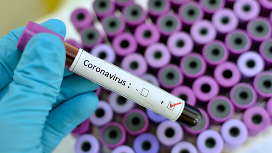 Image: Χρήσιμες πληροφορίες για τον κορωνοϊό από το Υπουργείο Υγείας