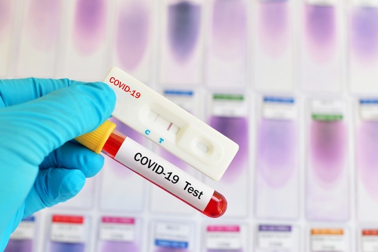 Image: Πιστοποιητικό νόσησης για τους ανεμβολιάστους μόνον με PCR τεστ