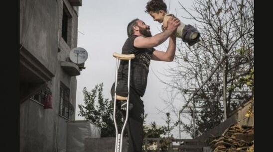 Image: Η συγκλονιστική ιστορία πίσω από τη φωτογραφία της χρονιάς: Η ζωή χωρίς άκρα για πατέρα και γιο από τη Συρία