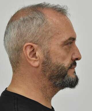 hxonews