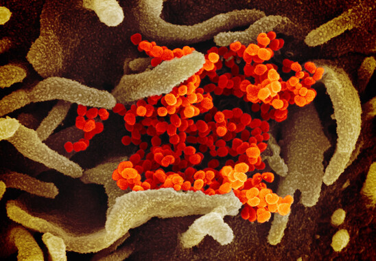 Image: Κορωνοϊός: Η Όμικρον προσφέρει ανοσία έναντι της λοίμωξης από άλλα στελέχη μόνο στους εμβολιασμένους